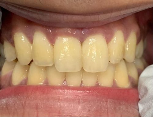 bf2e62f056ecf717e280fb3d9b874cc6_migrated